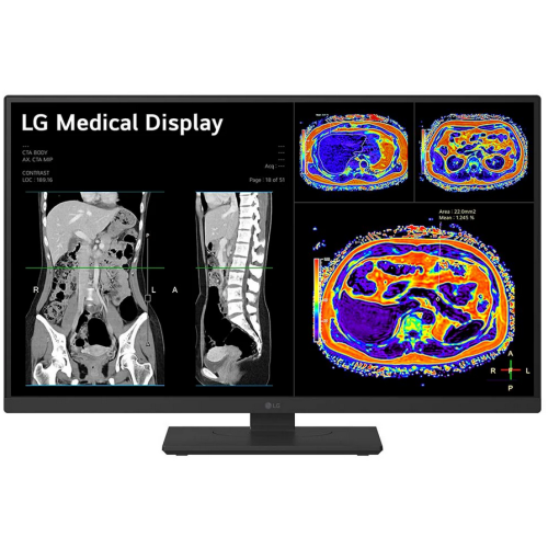 Monitor LG 27
