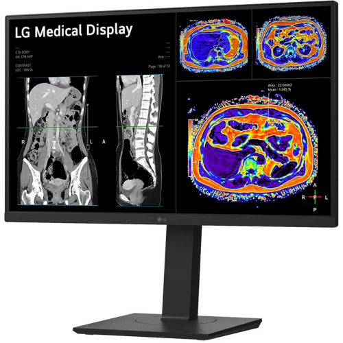 Monitor LG 27