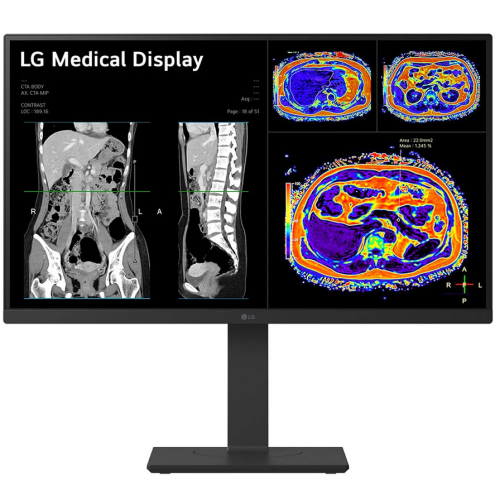Monitor LG 27