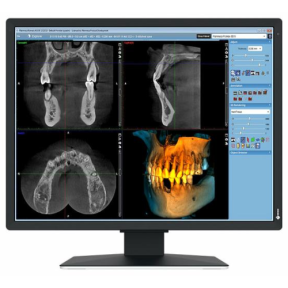 Monitor Eizo 21" MX217-SB